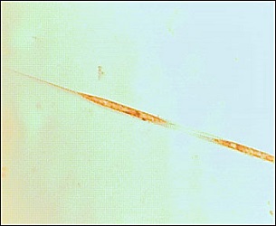 Rhizosolenia setigera