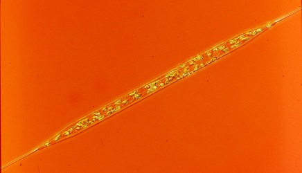 Rhizosolenia setigera