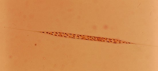 Rhizosolenia setigera