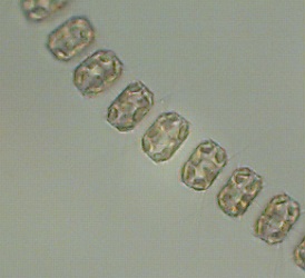 Thalassiosira nordenskioeldii