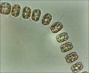 Thalassiosira nordenskioeldii