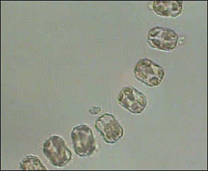 Thalassiosira nordenskioeldii