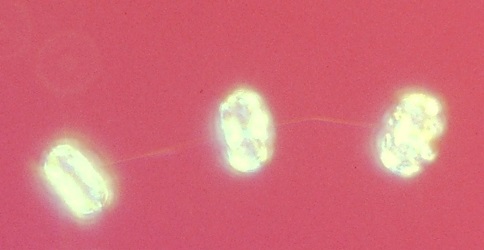 Thalassiosira pacifica