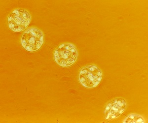 Thalassiosira pacifica